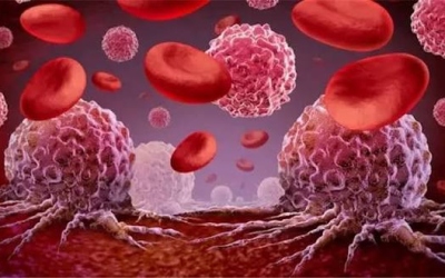 انخفاض هرمون التستوستيرون قد يرتبط بزيادة خطر السرطان