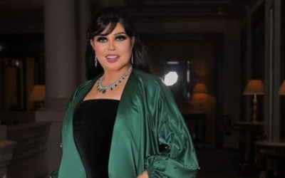 فيفي عبده تكشف تفاصيل حالتها الصحية بعد إصابتها بكسر في القدم