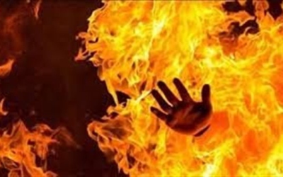 شخص يُقدم على إشعال النار في نفسه بجرش