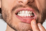 علامات في الفم قد تكشف عن أمراض تتجاوز الأسنان… متى يجب القلق؟