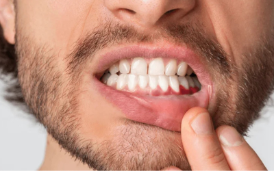 علامات في الفم قد تكشف عن أمراض تتجاوز الأسنان… متى يجب القلق؟