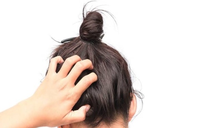 لماذا تشتد حكة فروة الرأس ليلاً؟