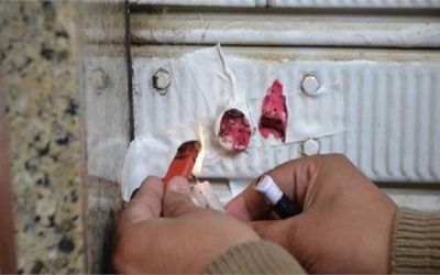إغلاق مركز أشعة بالشمع الأحمر بعد وفاة طفل